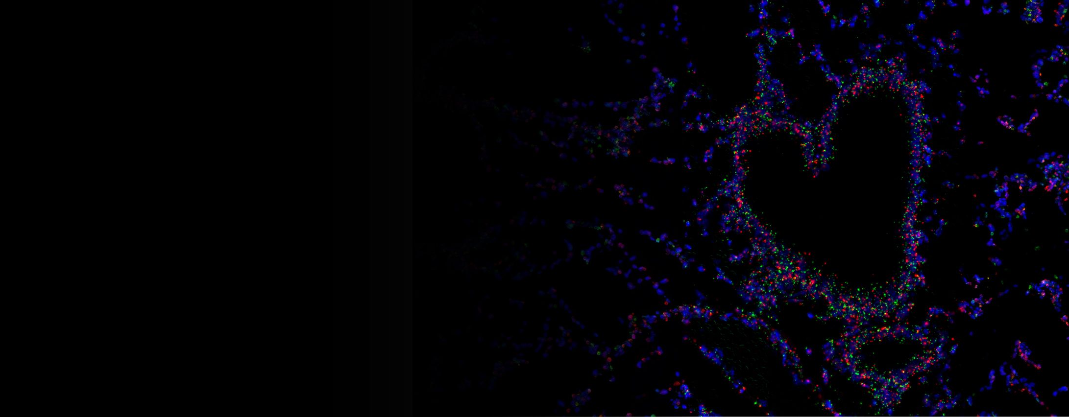 Cardiovascular Therapeutics